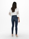 ONLY Dunkelblaue Skinny-Jeans ONLY Blush