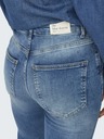 ONLY Blaue Damen-Skinny-Jeans ONLY Forever